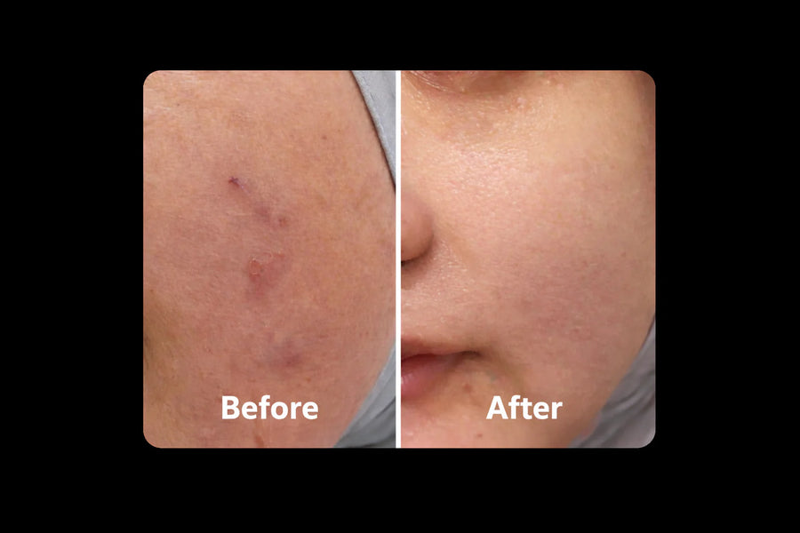 Faizatul Anum M. before and after